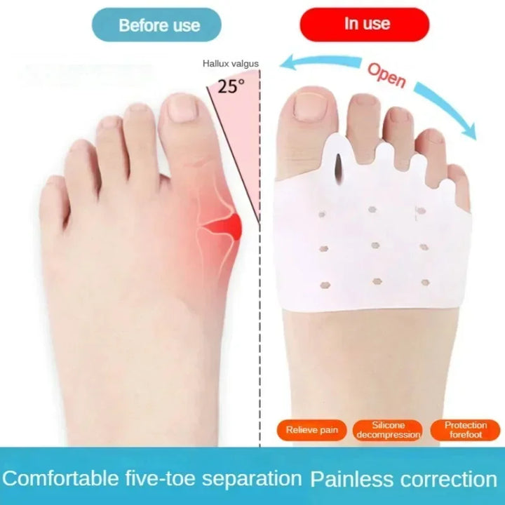 Cloudstep – Breathable Soft Gel Toe Support Pads for All-Day Walking Comfort + 50% OFF