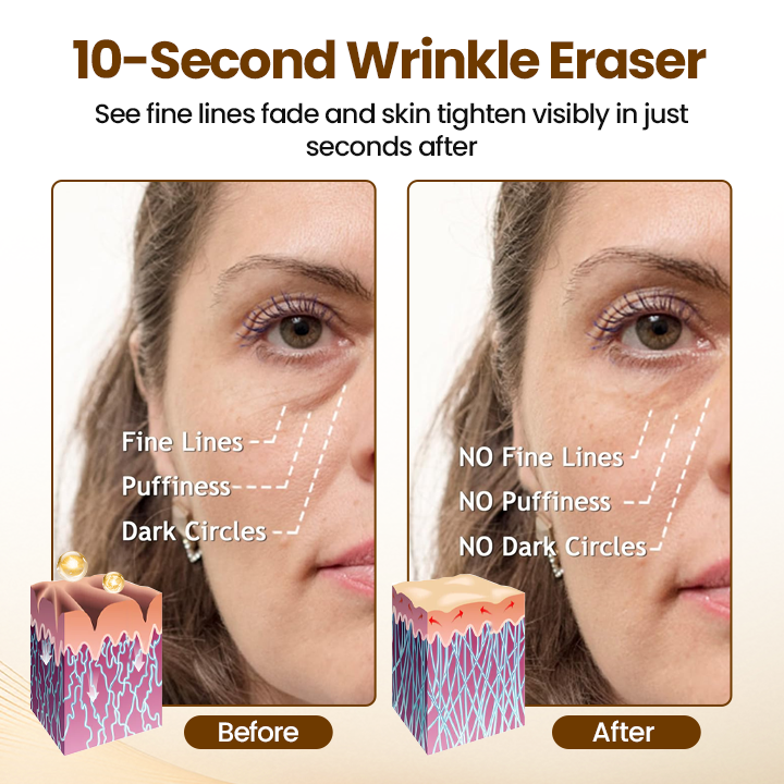 Newyuo – Erase 10 Years In 10 Seconds + 50% OFF