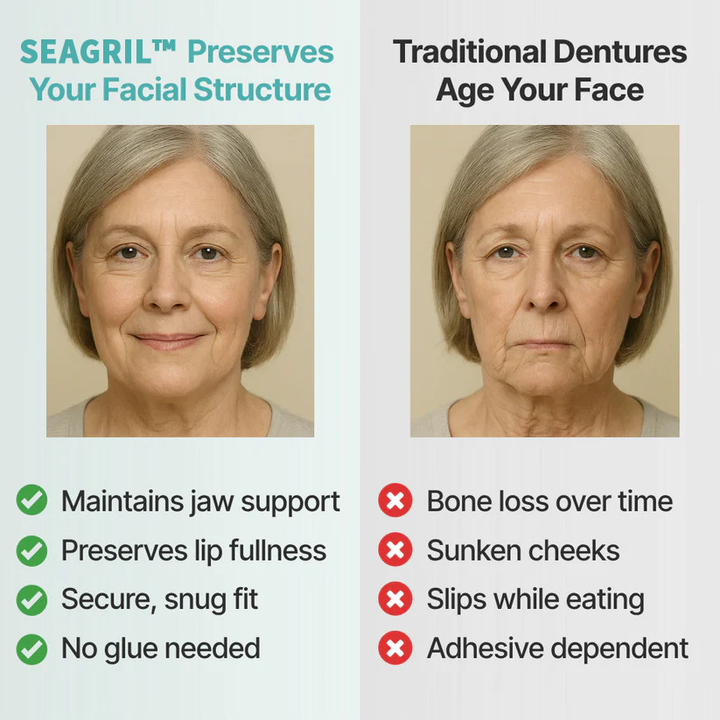 The InstaSmile Custom Dentures - Smile With Confidence Again + ENDS TODAY + 50% OFF