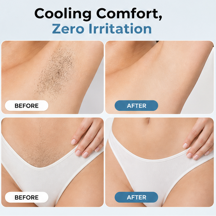 Frostelle – Ice Sensation Dual Hair Removal Cream for Underarms &amp; Bikini + 1+1 FREE features