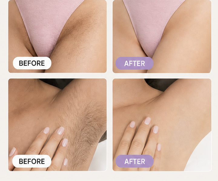 CloudSense – Pain-Free Bikini Hair Removal Cream &amp; Spray Kit + 1+1 FREE features